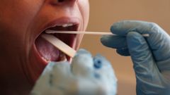 Regionen står parat til at bistå med test af op til 32.000 medarbejdere om ugen.