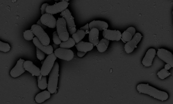 Her ses den B12-vitamin-producerende bakterie Propionibacterium freudenreichii gennem et elektronmikroskop. P. freudenreichii bruges til at lave schweizeroste som f.eks. emmentaler - og bakterien bruges nu også i plantefermenteringer. Foto: Paulina Deptula.