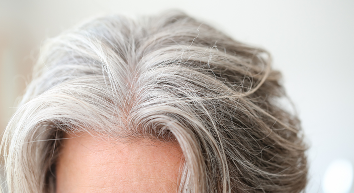 Tidlig aldring som gråt hår og rynker er symptomer på neurologiske sygdomme som Werner syndrom. Det er ved blandt andet at undersøge den sygdom, at forskere fra KU nu har udviklet potentiel ny behandling til kræft. Foto: Canva.
