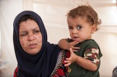 Khadija, en 22-årig mor til tre, var på vej gennem et minefelt med den etårige Mahmoud i sine arme, da eksplosionen forandrede deres liv for altid. Foto: Peter Eilertsen for Mission Øst.