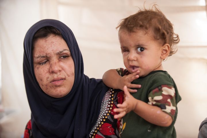 Khadija, en 22-årig mor til tre, var på vej gennem et minefelt med den etårige Mahmoud i sine arme, da eksplosionen forandrede deres liv for altid. Foto: Peter Eilertsen for Mission Øst.
