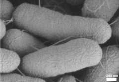 E. coli bakterie uden beskyttelsesdragt.