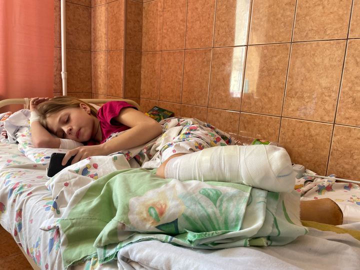 11-årige Yana er indlagt på Lviv Hospital. Hun mistede begge ben i et missilangreb på banegården i Kramatorsk.