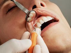 Går du regelmæssigt til tandlægen, får du både øget sundhed og et bedre tandsæt. Det har flest kvinder fundet ud af. Helt nye tal viser, at de er bedst til at passe på tænderne, især inden de har rundet 40 år. Foto: PR.