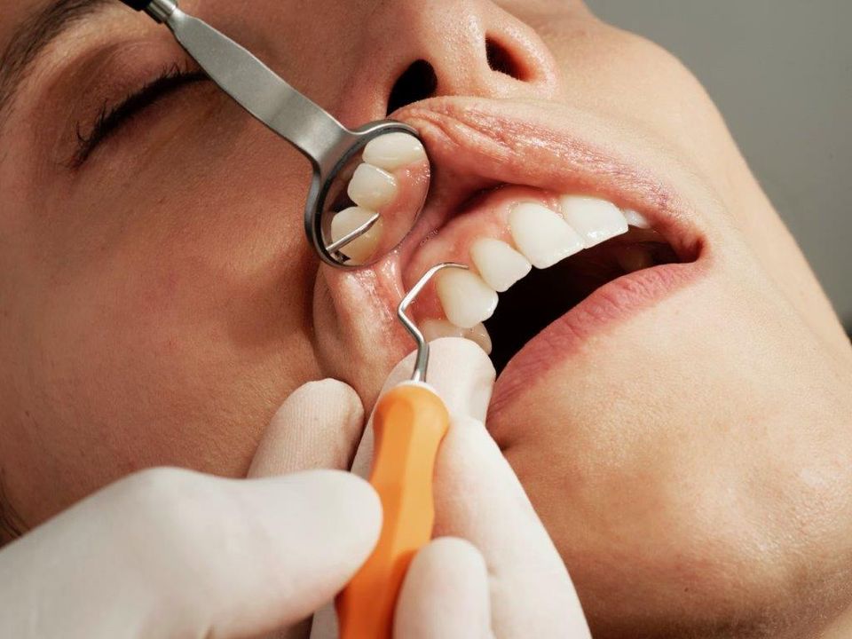 aktivering skab frø Afsløring: Kvinder er bedst til at passe på tænderne | Oris Tandlægerne