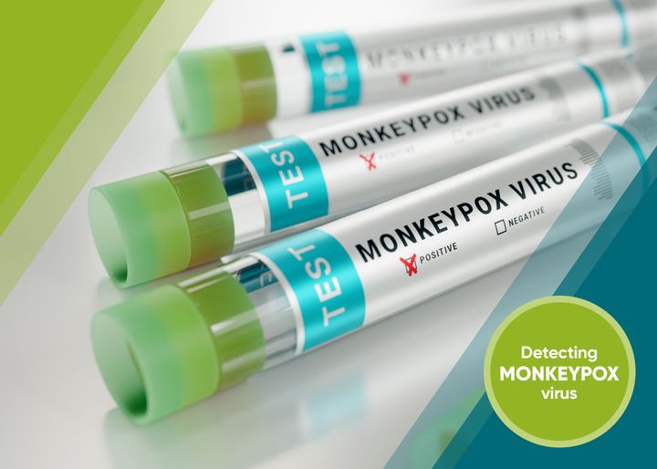 R-Biopharm develops a test for research purposes to track and control the spread of the monkeypoxvirus.