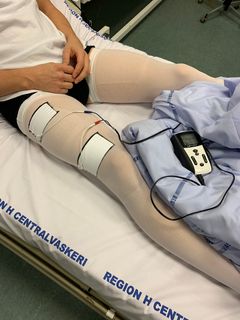 Støttestrømper med elektrisk muskelstimulering i funktion. Foto: Bispebjerg Hospital
