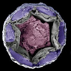 Mikroskopisk tværsnit af billens bagtarm. Billedet viser den tørre afføring i magentafarver omkranset af tarmen i grå. Billens nyrerør ses i lilla. Foto: Kenneth Veland Halberg.