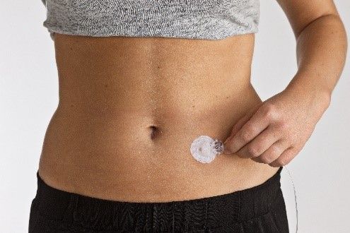 Infusionssæt fra ConvaTec