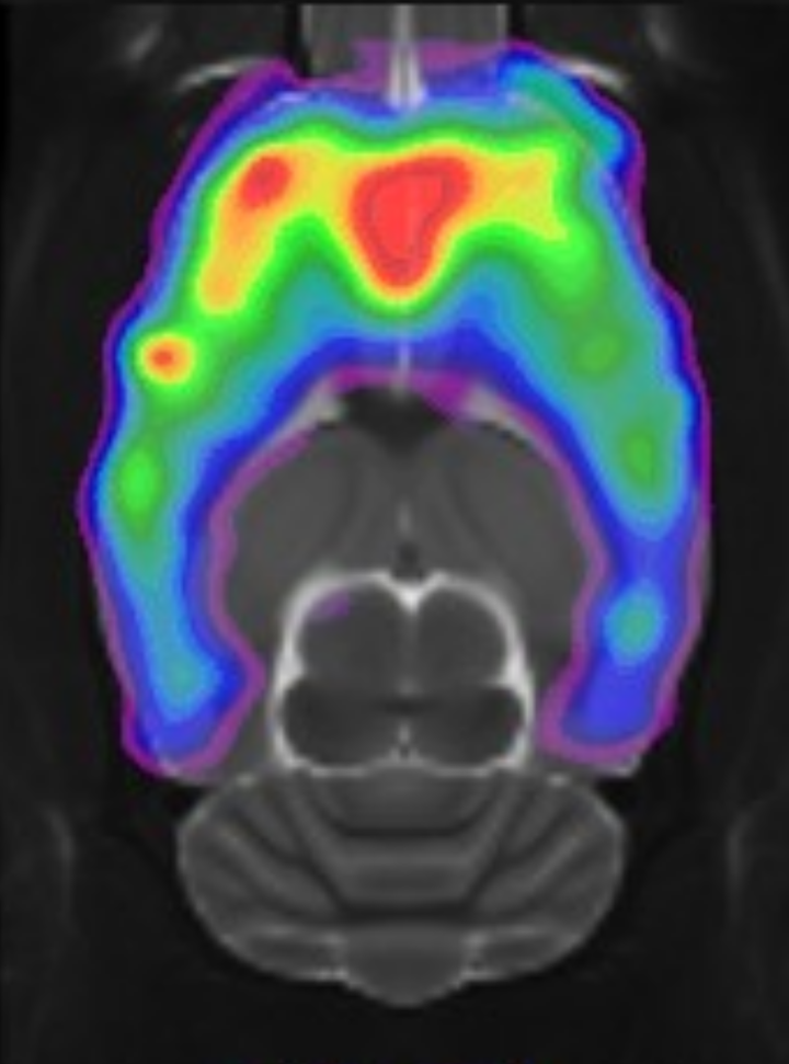 Scanningsbillede af en rottehjerne med serotonin 5-HT2A receptoren, som påvirkes af psylocobin.