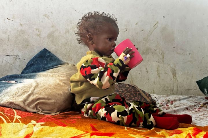 3-årige Shimba drikker terapeutisk mælk på Port Sudan Pediatric Hospital, hvor han har været i 20 dage. Han lider af alvorlig akut underernæring.