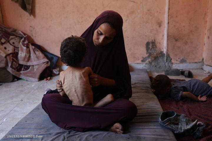 To-årige Yazan lider af akut underernæring. Han bor med sin mor i en flygtningelejr i Gaza By.