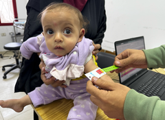 Et barn undersøges for underernæring i Gaza By.