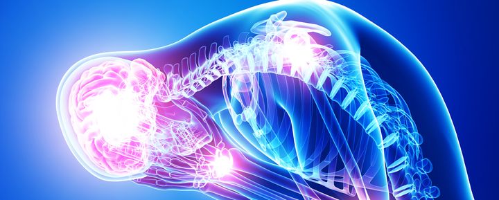 Foto: Adobe Stock - grafisk fremstilling af menneske med smerte