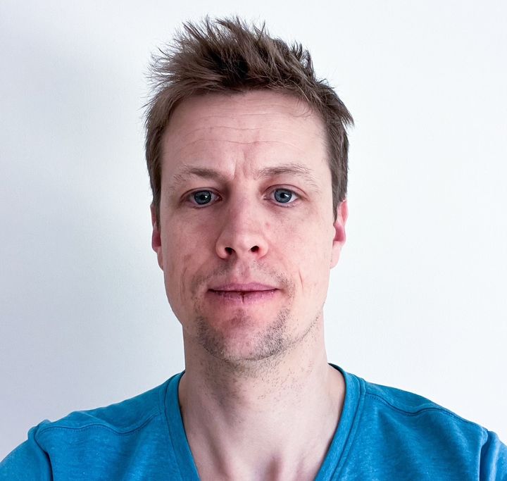 Jakob Kirkegård er ny doktor i kirurgisk behandling af bugspytkirtelkræft og tilknyttet både Institut for Klinisk Medicin og Afdeling for Mave- og Tarmkirurgi på Aarhus Universitetshospital.