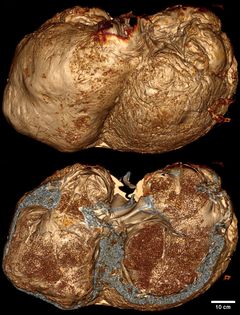 Scanningsbilleder af det store hjerte