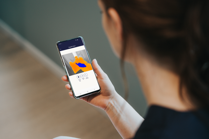 Sensorerne registrerer og viser udelukkende beboerne som blå omrids (foto: Sensio)