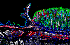 This image showcases a tissue section from the gastroesophageal junction  of a mouse, illustrating thespatial distribution of various cell types through immunostaining: CDH1 in green identifying epithelial cells, POSTN in red and ACTA2 in white delineating distinct fibroblast subpopulations, with nuclei stained blue.