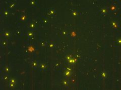 Sådan ser det mikrobielle samfund i jorden ud gennem et fluorescensmikroskop. De mindste lysende prikker er virus.