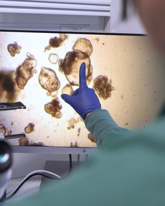 Sådan ser en organoide ud i laboratoriet på Institut for Bio- og Kemiteknologi. Forskerne har dyrket mini-tarmen ud fra patientens egne stamceller.