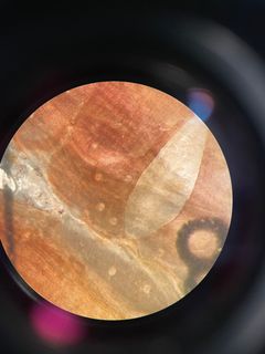 Parasitterne sætter deres spor. Her er muslingevæv vist under mikroskop. De små lyse cirkler i blåmuslingens væv er cyster dannet af parasitter. Parasitlarver kan komme ind i muslingen med den vandstrøm, som den bruger til at filtrere føde fra havvandet. Derfor står muslingen med et dilemma: Jo mere den filtrerer, desto større kan risikoen for ubudne gæster være.