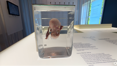 En livmoder i centrum:  En kvinde har doneret sin livmoder til udstillingen Den oversete krop - blod, bryster og ulighed for at sætte fokus på sygdommen endometriose