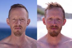 Før- og efter-billede af Simon Svendsen