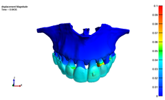 A digital twin of a patient's jaw created through the integration of AI solutions and computational modeling, enabling precise simulation of anticipated teeth movements under specific conditions. The color map visually represents the extent and direction of teeth movement, with warmer colors indicating higher teeth movements. Photo: Department of Computer Science