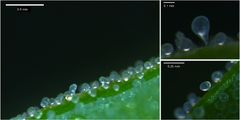 Bladder cells seen through a microscope