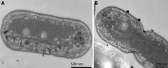 Cyanobakterieceller med proteintråde set gennem mikroskop. Proteintrådene er markert med 'F'