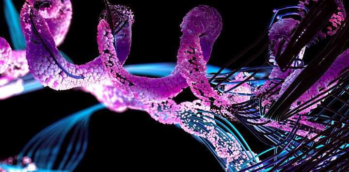 The researchers' machine learning algorithm can spot protein clumps down to a billionth of a meter in microscopy images. At the same time, the algorithm can count and then group clumps according to their shapes and sizes, all while tracking their development over time. Photo: Getty