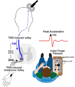 Timed stimulations – electrical stimulation through the forearm and magnetic stimulation via a coil on the head – collide in the spinal nerve pathways and are believed to create new connections.
