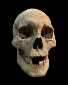 Kraniet af en voksen kvinde (25-35 år) smittet med pest og begravet i Ust’Ida-grav nr. 16. Ancient DNA blev udvundet fra en af hendes kindtænder.