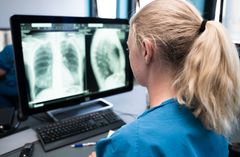 Sundhedsfaglig medarbejder ser på skærm med røntgenbilleder af brystkasse