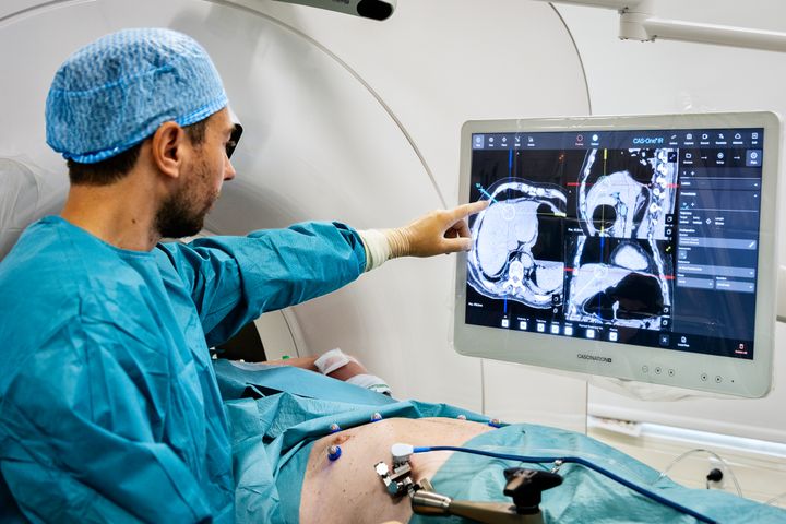 Region Midtjylland fordeler nu 38 millioner kroner til en bred vifte af indsatser på kræftområdet i 2025. Pengene kommer fra regeringens Kræftplan V og skal blandt andet styrke palliation, screening og kapacitet på de somatiske hospitaler.