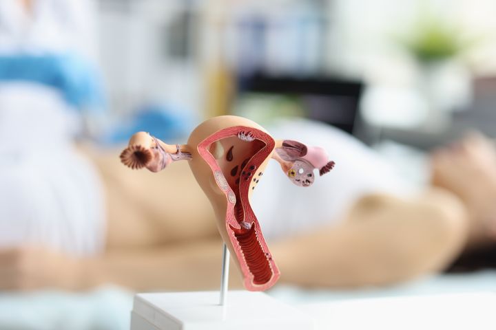 Model af livmoder som er sat op foran en hospitalsseng, hvor en kvinde får udført en ultralydsundersøgelse af livmoderen.