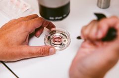 Fertilitetsbehandlingen foregår delvist under mikroskop.