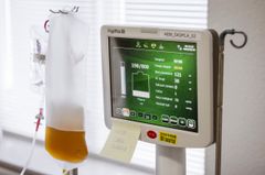 Blodet fra donor bliver via en nål i armen ledt over i plasmaudstyr, hvor det bliver centrifugeret, og det gule plasma bliver suget op i en pose, der opsamler de vigtige gyldne dråber. Derefter føres blodet tilbage til donoren, og kroppen producerer nyt plasma.