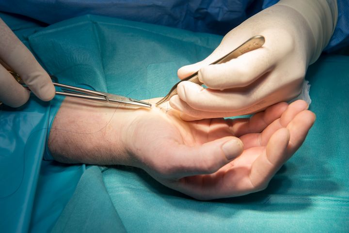 Efter sommerferien skruer Regionshospitalet Randers op for kapaciteten på det håndkirurgiske område.