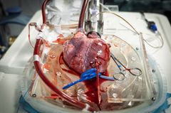 Forskerne har placeret små katetre direkte i hjertemusklen for at kunne overvåge grisehjertet tæt under opbevaring og transplantation.