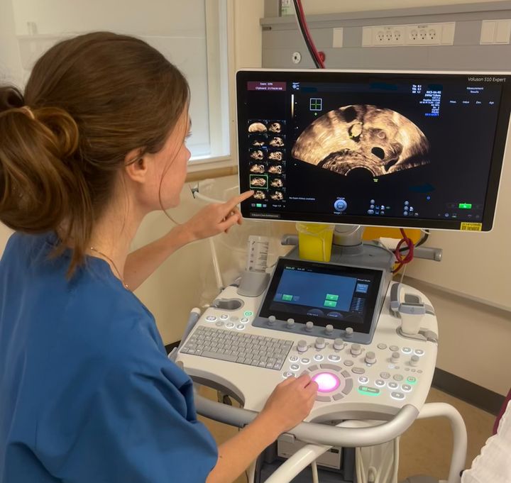 Læge og ph.d. Ina Marie Dueholm Hjorth ved ultralydsscanner.