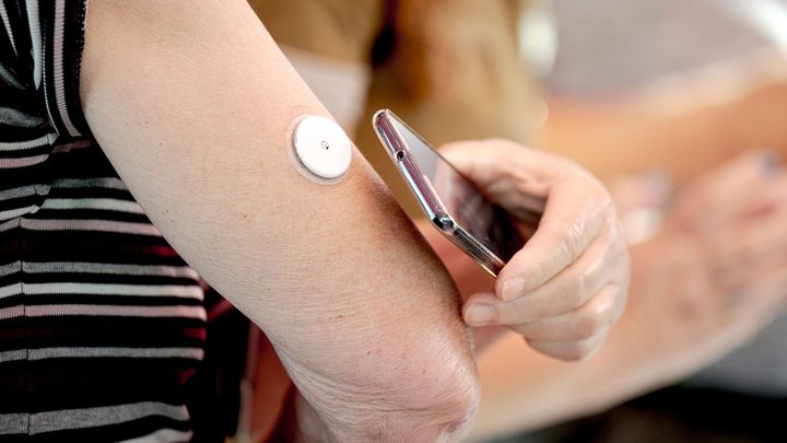 Arm med glukosesensor til diabetes og mobiltelefon, der aflæser den
