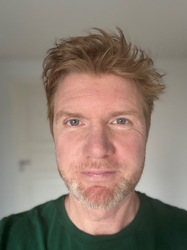 Læge Søren Brynald fortæller at mange slet ikke overvejer, at husstøvmider kan være årsagen til deres symptomer, fordi de konstant bliver udsat for allergenet i hjemmet og derfor hele tiden har symptomer.