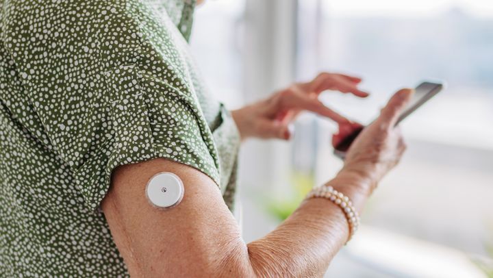 Blodsukkeret vurderes i dag ud fra de seneste 14 dage. Med automatiseret dataanalyse håber forskere at gøre det muligt også at opdage mønstre over måneder og år.